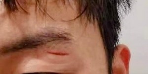 【大发体育】血染赛场！记者：杨梓豪眉骨部位被肘击，已经去医院做了处理，大发助力你的致富之路！