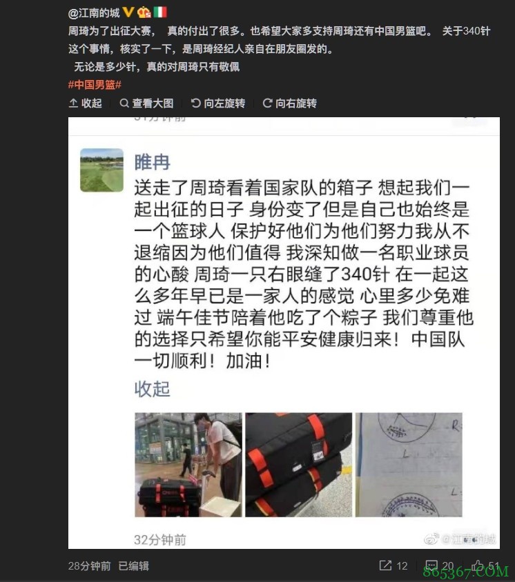 睢冉朋友圈：周琦一只右眼缝了340针