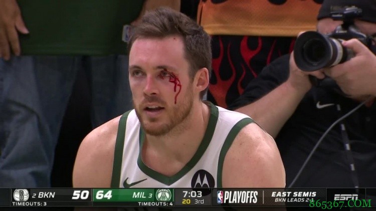 康诺顿谈被击打面部:不喜欢 但这是比赛的一部分