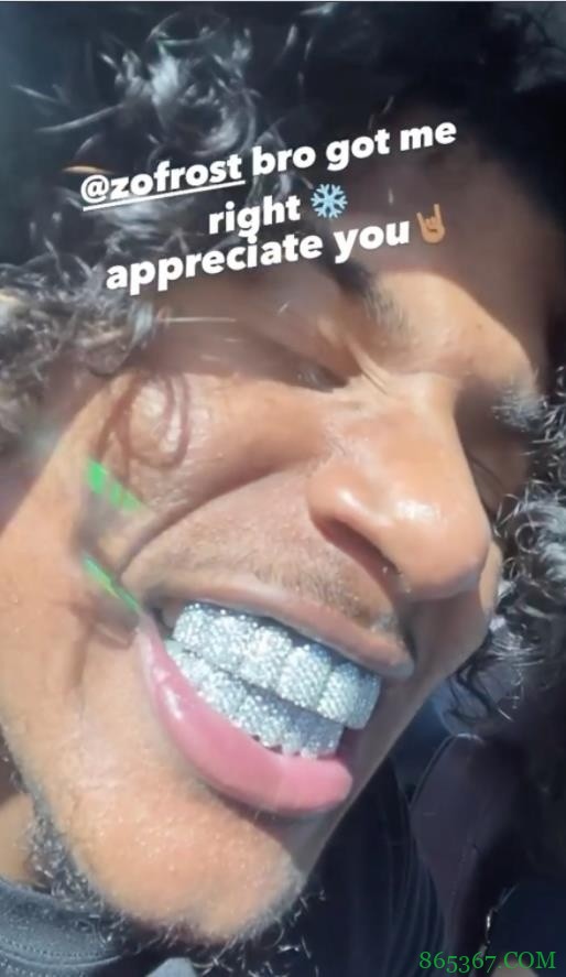 BlingBling！杰伦-格林戴镶钻牙套?