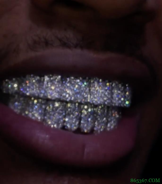 BlingBling!杰伦-格林戴镶钻牙套?