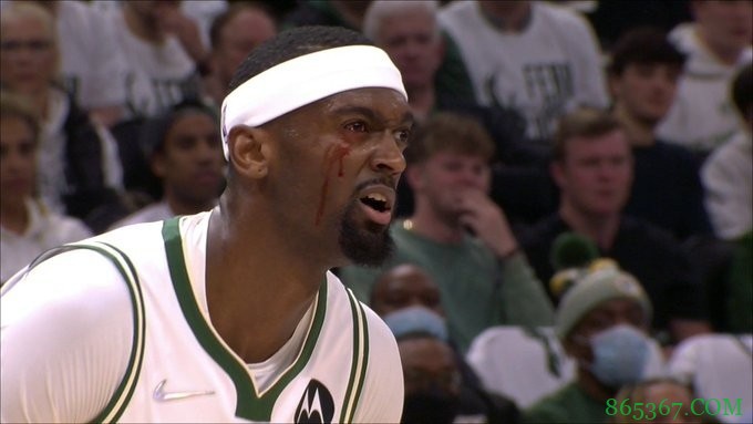 布登谈波蒂斯伤势：他右眼有擦伤 预计能在一段时间内康复