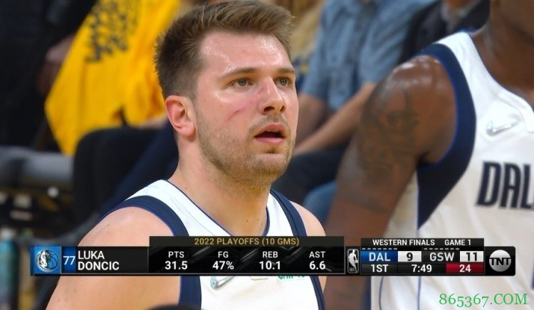 东契奇谈脸上抓痕:还不错 这让我看起来像个硬汉