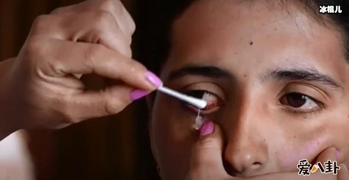 一女子眼睛竟流出“钻石”?深扒其真实原因是什么?